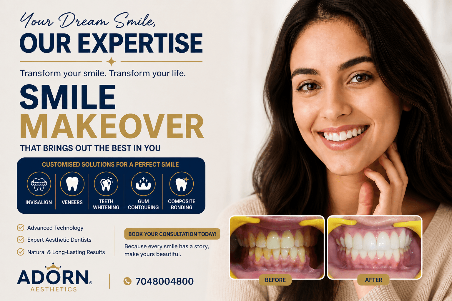 Smile Makeover in Ahmedabad: Invisalign, Veneers cost & Complete Dental Transformation at Adorn Aesthetics teeth-whitening-veneers-invisalign-ahmedabad